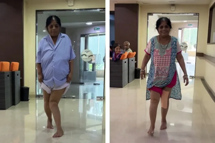 Harshaben Patel, Before & After Surgery