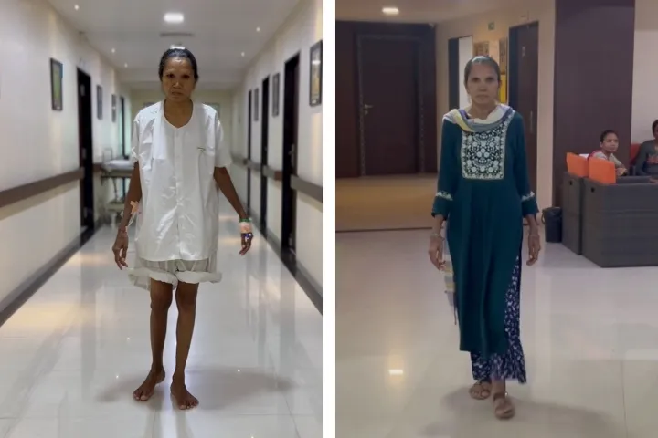 Rasila Vasava, Before & After Surgery