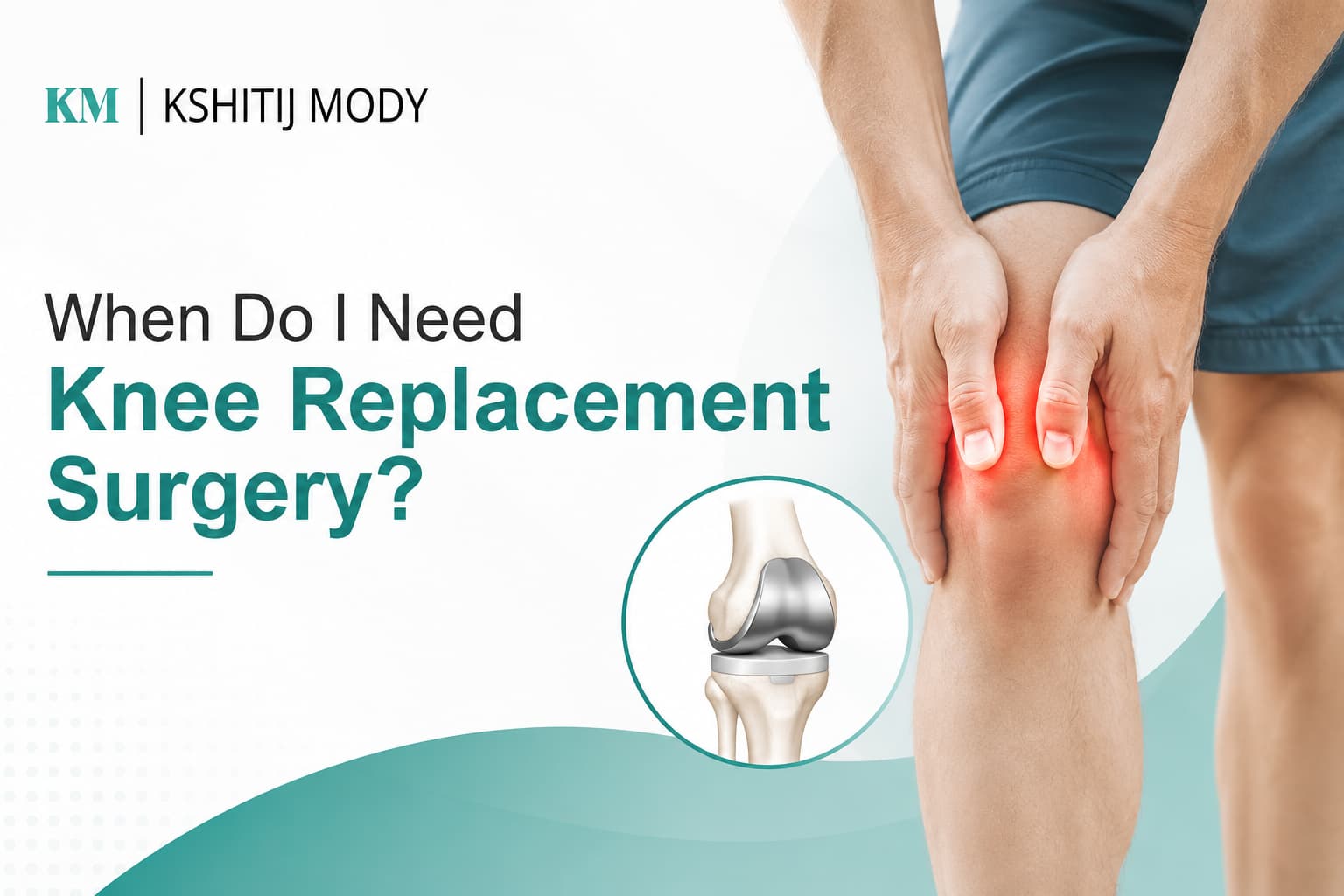 When Do I Need Knee Replacement Surgery